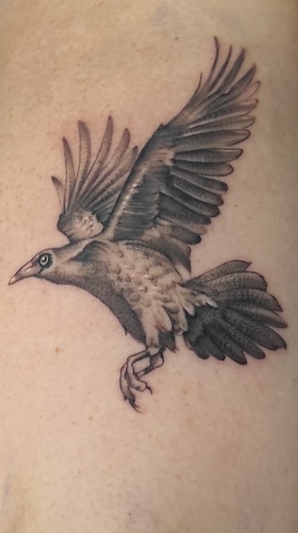 antes y después de borrado de tatuaje